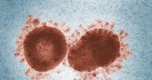 A pandemic in the making