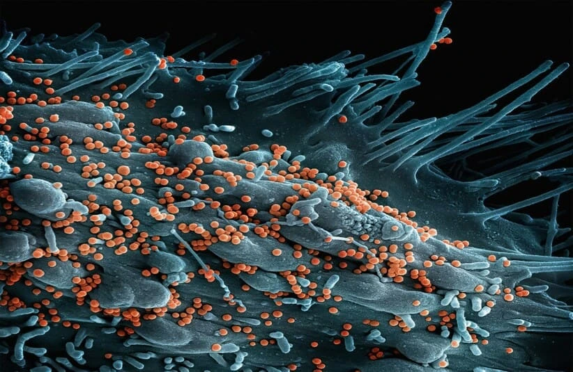 Electron microscope image of measles on a cell surface. Blue cell structure with orange viral particles, resembling a jagged landscape, evoking a scientific tone.