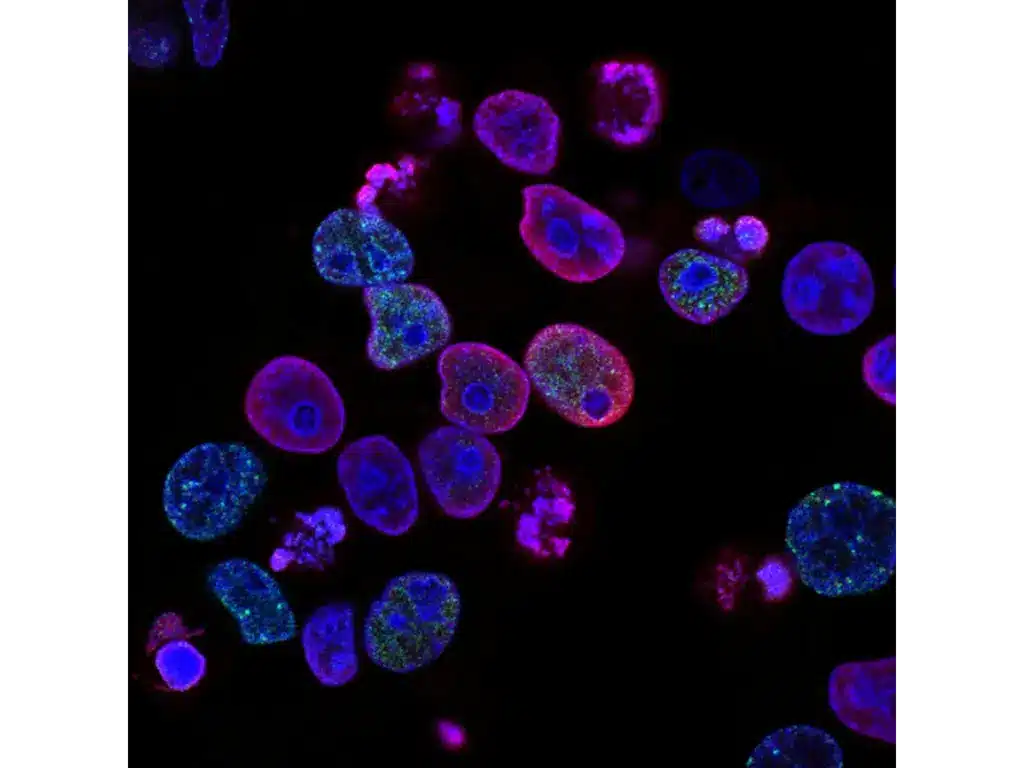 evolution of Cancer Cells.