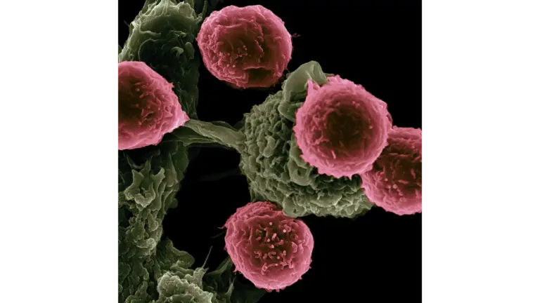 X-ray of cancer cells.
